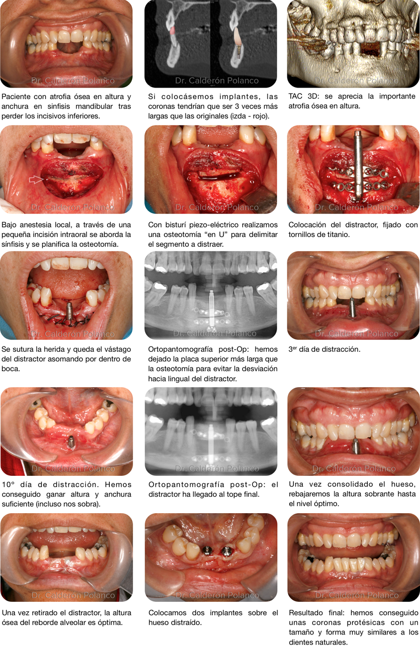 Cómo DEFINIR tu mandíbula Rápido, sin Cirugía y sin Dañar tus Dientes😲? 