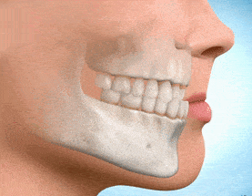 relacion labio dientes 2